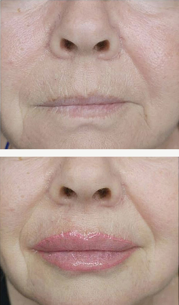 labios-4